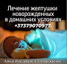 Аренда лампы .Лечение желтухи новорожденных..(высокий Билирубин)
