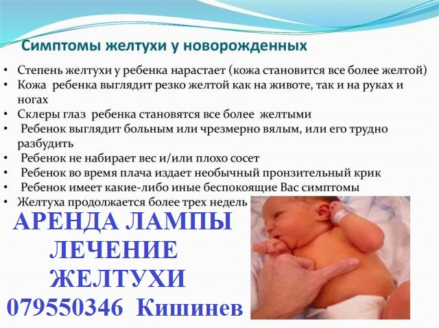 Лампа для лечения желтухи у малышей (высокий Билирубин). Кишинев - imagine 1