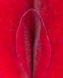 Интимная пластика: уменьшение малых половых губ (Лазерная Лабиопластик