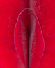 Лазерная лабиопластика малых половых губ Интимная пластика: уменьшение