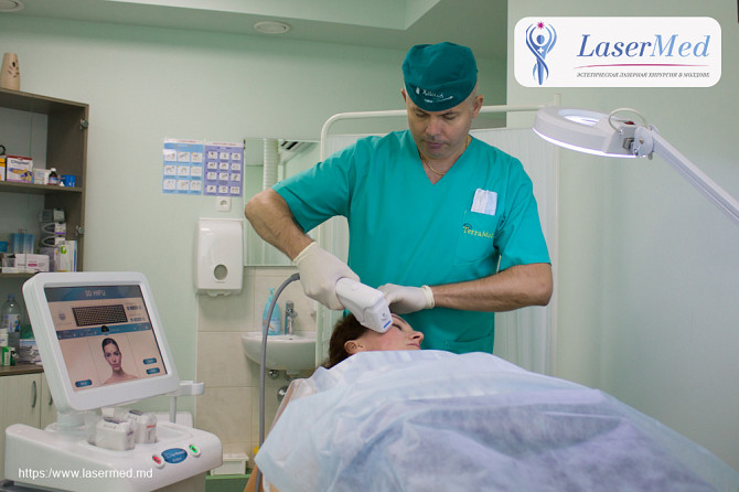 Face lift "Nefertiti" prin metoda 3D HIFU SMAS-Ultrasunetele focusate - imagine 1