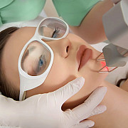 Tratament cu laser pentru inlaturarea (indepartarea) si eliminarea a p