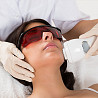 Tratament cu laser a acneei si sechelelor postacnee (cicatricilor dupa