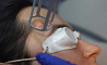 Rejuvenare cu laser a pleoapelor in Moldova (Chisinau)!