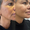 Oferte speciale de vara si reduceri pana la -40%! Face lift "Neferti