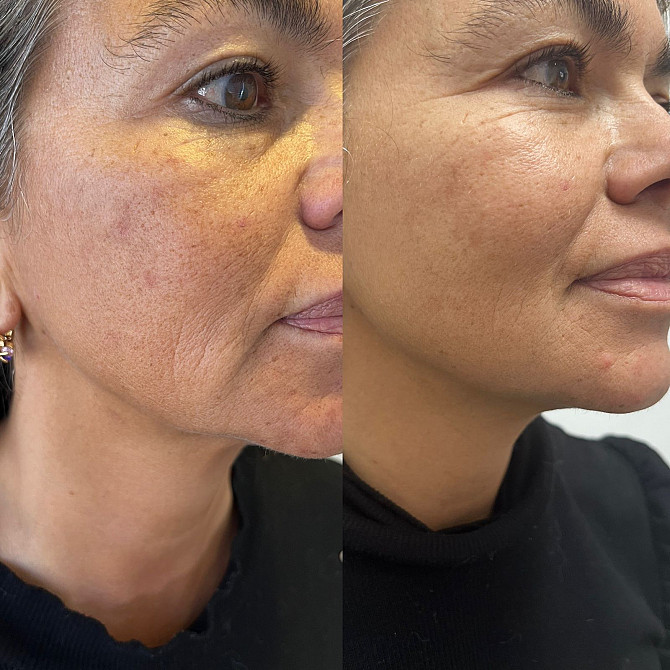 Oferte speciale de vara si reduceri pana la -40%! Face lift "Neferti - изображение 1