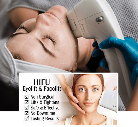 CONCURS – Câștigă un tratament 3D HIFU Lifting Facial în valoare de 60 - изображение 1